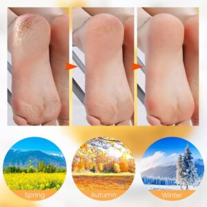 Silicone Socks Heal Repairing & Moisturizing Spa Socks